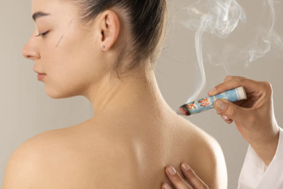Moxibustion treatment example 1
