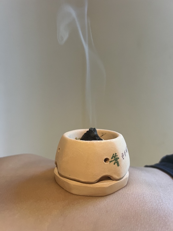 Moxibustion treatment example 2